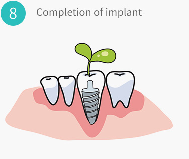 Completion of implant